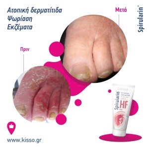 Spirularin Gel φροντίδας για ευαίσθητο και ξηρό δέρμα