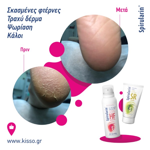 Spirularin  Mousse Plus για πολύ ξηρό δέρμα και πόδια