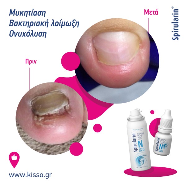 Spirularin NS serum νυχιών,10ml