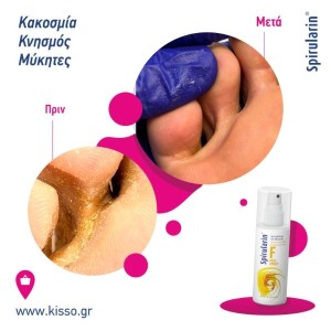 Spirularin F spray ειδική φροντίδα με αντιμυκητιακή δράση,100ml